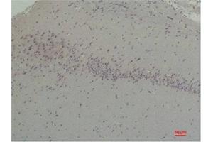 Immunohistochemistry (IHC) analysis of paraffin-embedded Rat Brain Tissue using CABP2 Rabbit Polyclonal Antibody diluted at 1:200. (CABP2 anticorps)