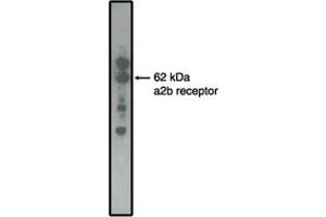Image no. 1 for anti-Adrenergic, alpha-2B-, Receptor (ADRA2B) antibody (ABIN201731) (ADRA2B anticorps)