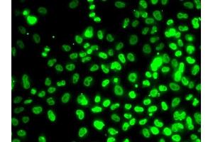 Immunofluorescence analysis of MCF7 cells using RP antibody (ABIN6128655, ABIN6147086, ABIN6147088 and ABIN6222439). (RPA3 anticorps  (AA 6-121))