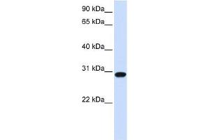 FOXR1 antibody used at 0. (FOXR1 anticorps  (N-Term))