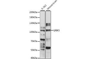 Western blot analysis of extracts of various cell lines, using GRIK5 antibody (ABIN7267416) at 1:1000 dilution. (GRIK5 anticorps  (AA 350-420))