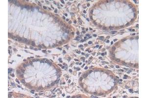 Detection of PCSK5 in Human Stomach Tissue using Polyclonal Antibody to Proprotein Convertase Subtilisin/Kexin Type 5 (PCSK5)