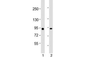 Western blot testing of human 1) Raji and 2) HeLa cell lysate with MYBL2 antibody at 1:2000. (MYBL2 anticorps  (AA 245-278))