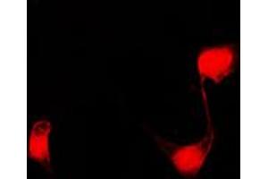 Immunofluorescent analysis of PPHLN1 staining in COLO205 cells. (PPHLN1 anticorps  (Center))