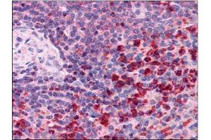 Immunohistochemistry Image: Human Spleen: Formalin-Fixed, Paraffin-Embedded (FFPE)