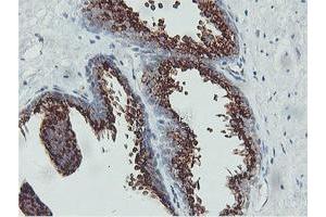 Image no. 9 for anti-Golgi Membrane Protein 1 (GOLM1) antibody (ABIN1498496)