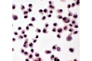 Anti-Nucleophosmin antibody, ICC ICC: HELA Cell