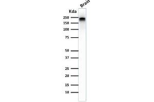 anti-Neurofilament, Heavy Polypeptide (NEFH) antibody