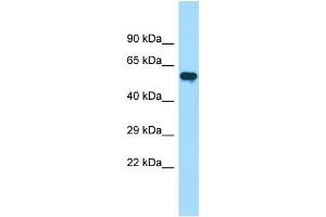 WB Suggested Anti-PIP5K1B Antibody Titration: 1. (PIP5K1B anticorps  (C-Term))
