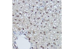Immunohistochemistry of paraffin-embedded rat liver using DDB1 Rabbit pAb (ABIN1679509, ABIN5664466, ABIN5664468 and ABIN6220382) at dilution of 1:350 (40x lens). (DDB1 anticorps  (C-Term))