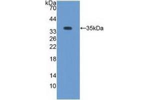 Western blot analysis of recombinant Rabbit PKCb1. (Pkc beta 1 anticorps)