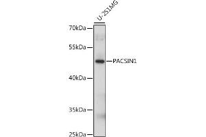 Western blot analysis of extracts of U-251MG cells, using P antibody (ABIN7269626) at 1:1000 dilution. (PACSIN1 anticorps  (AA 240-390))