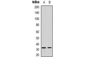 Western blot analysis of FOXE3 expression in SHSYSY (A), MDAMB435 (B) whole cell lysates. (FOXE3 anticorps)