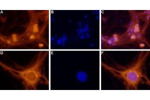 Expression of Adenosine A1 Receptor in rat DRG primary culture - Immunocytochemical staining of paraformaldehyde-fixed and permeabilized rat dorsal root ganglion (DRG) primary culture.