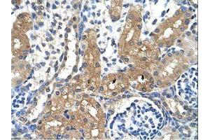 Image no. 1 for anti-Cytochrome P450, Family 4, Subfamily A, Polypeptide 22 (CYP4A22) (N-Term) antibody (ABIN6736345)