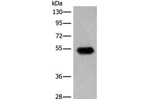 Western blot analysis of Human fetal brain tissue lysate using CDT1 Polyclonal Antibody at dilution of 1:400 (CDT1 anticorps)