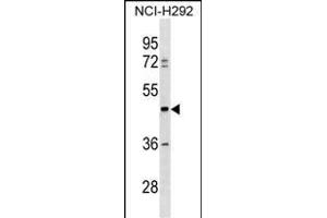 TULP3 Antibody (C-term) (ABIN1537220 and ABIN2850401) western blot analysis in NCI- cell line lysates (35 μg/lane). (TULP3 anticorps  (C-Term))