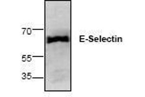 Image no. 1 for anti-Selectin E (SELE) antibody (ABIN127258) (Selectin E/CD62e anticorps)