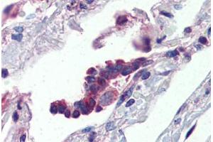 Human Lung, Respiratory Epithelium (formalin-fixed, paraffin-embedded) stained with PLUNC antibody ABIN462235 followed by biotinylated goat anti-rabbit IgG secondary antibody ABIN481713, alkaline phosphatase-streptavidin and chromogen.