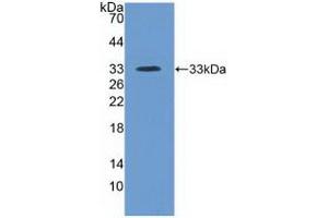 Detection of Recombinant ITIH4, Human using Polyclonal Antibody to Inter Alpha-Globulin Inhibitor H4 (ITIH4)