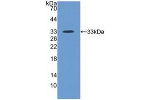 Detection of Recombinant ITIH4, Human using Polyclonal Antibody to Inter Alpha-Globulin Inhibitor H4 (ITIH4) (ITIH4 anticorps  (AA 683-928))