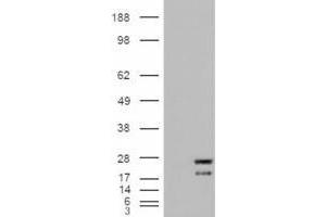 HEK293 overexpressing NRAS (ABIN5357760) and probed with ABIN302138 (mock transfection in first lane).