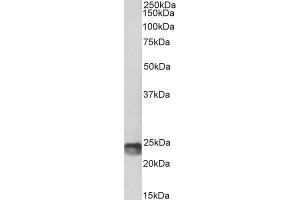 Biotinylated ABIN5539590 (1µg/ml) staining of Mouse Spleen lysate (35µg protein in RIPA buffer). (SOCS1 anticorps  (C-Term) (Biotin))