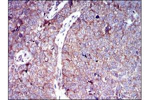 Immunofluorescence analysis of HeLa cells using SLC2A4 antibody (green).
