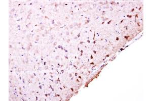 IHC-P Image PFKFB4 antibody [N3C3] detects PFKFB4 protein at cytosol on mouse middle brain by immunohistochemical analysis.