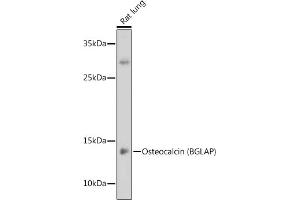 Western blot analysis of extracts of Rat lung, using Osteocalcin (BGLAP) antibody (ABIN6134565, ABIN6137546, ABIN6137547 and ABIN6221793) at 1:1000 dilution.