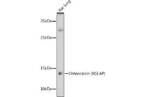 Western blot analysis of extracts of Rat lung, using Osteocalcin (BGLAP) antibody (ABIN6134565, ABIN6137546, ABIN6137547 and ABIN6221793) at 1:1000 dilution. (Osteocalcin anticorps  (AA 1-100))
