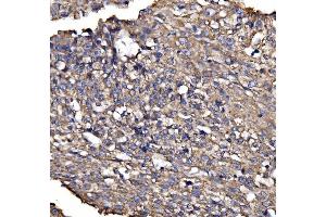 IHC analysis of BRSK1 using anti-BRSK1 antibody (ABIN7600990).