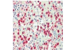 Immunohistochemistry analysis of Cathepsin G Antibody in paraffin-embedded human spleen tissue at 1/100. (Cathepsin G anticorps)
