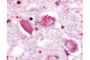 Anti-GPR85 antibody IHC of human putamen, neurons. (GPR85 anticorps  (Cytoplasmic Domain))