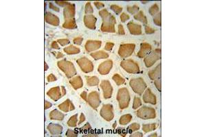 DHRS7 Antibody immunohistochemistry analysis in formalin fixed and paraffin embedded human skeletal muscle followed by peroxidase conjugation of the secondary antibody and DAB staining. (DHRS7 anticorps  (N-Term))