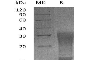 Interleukin 13 (IL13) (AA 26-131) (Active) protein (His tag)