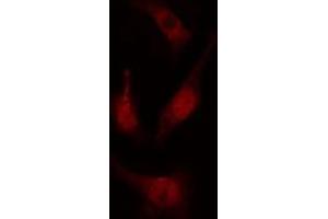 ABIN6274699 staining COLO205 cells by IF/ICC. (PRP19 anticorps  (N-Term))