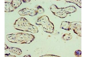 Immunohistochemistry of paraffin-embedded human placenta tissue using ABIN7176567 at dilution of 1:100