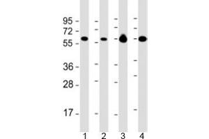 Western blot testing of 1) Daudi, 2) HL-60 cell lysate, 3) human brain and 4) mouse brain lysate with PACSIN2 antibody at 1:2000. (PACSIN2 anticorps  (AA 250-486))