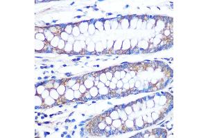 Immunohistochemistry of paraffin-embedded human colon using [KO Validated] FGF2 Rabbit mAb (ABIN7267184) at dilution of 1:100 (40x lens). (FGF2 anticorps)