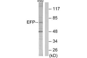Western blot analysis of extracts from K562 cells, using ZNF147 antibody. (TRIM25 anticorps  (Internal Region))