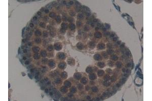 Detection of SP-B in Rat Testis Tissue using Polyclonal Antibody to Surfactant Protein B (SP-B)