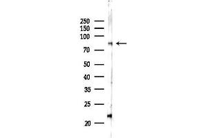 anti-Calpain 13 (CAPN13) (N-Term) antibody