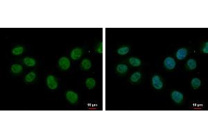 ICC/IF Image splicing factor 1 antibody [N1N3] detects splicing factor 1 protein at nucleus by immunofluorescent analysis.