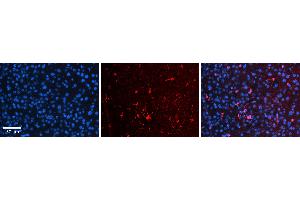 Rabbit Anti-OSBPL8 Antibody   Formalin Fixed Paraffin Embedded Tissue: Human Liver Tissue Observed Staining: Cytoplasm and plasma membrane in Kupffer cells and sinusoids Primary Antibody Concentration: 1:100 Other Working Concentrations: 1:600 Secondary Antibody: Donkey anti-Rabbit-Cy3 Secondary Antibody Concentration: 1:200 Magnification: 20X Exposure Time: 0.
