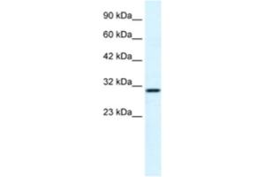Western Blotting (WB) image for anti-FLJ20729 antibody (ABIN2460993) (FLJ20729 anticorps)