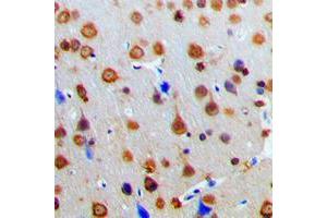Immunohistochemical analysis of AKAP13 staining in human brain formalin fixed paraffin embedded tissue section. (AKAP13 anticorps  (Center))