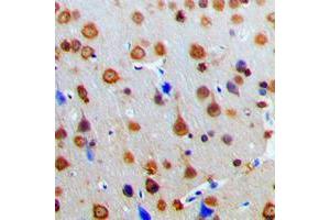 Immunohistochemical analysis of AKAP13 staining in human brain formalin fixed paraffin embedded tissue section.