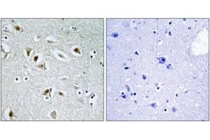 Immunohistochemistry analysis of paraffin-embedded human brain tissue, using CDKA2 Antibody. (CDK2AP2 anticorps  (AA 51-100))