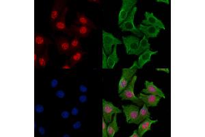 ABIN7093538 and ABIN7097562 staining Hela cells by IF/ICC. (RPA2 anticorps)